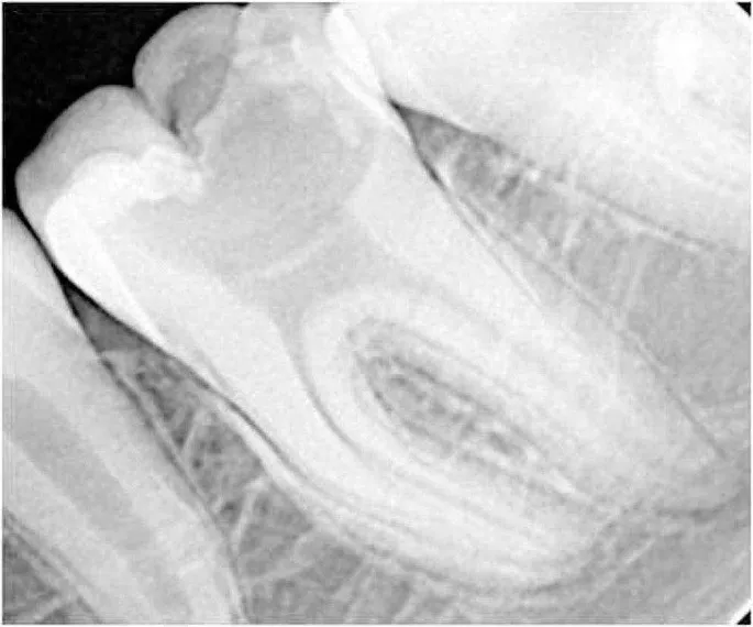 From Wisdom Teeth to Dental Implants: An In-Depth Walkthrough of Common Oral Surgery Procedures, Risks, and Long-Term Outcomes
